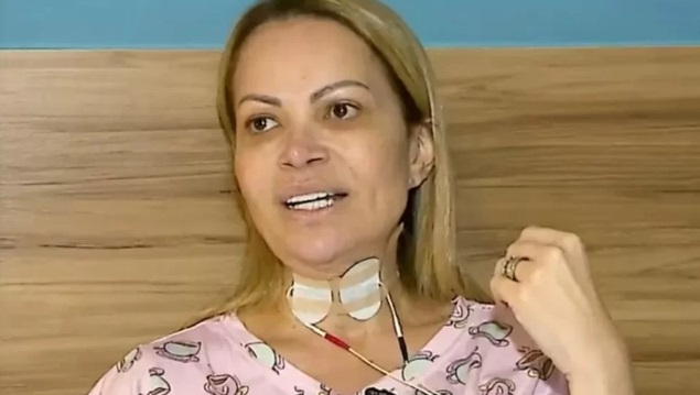 Solange Almeida revela que adquiriu problema de saúde após usar cigarros eletrônicos